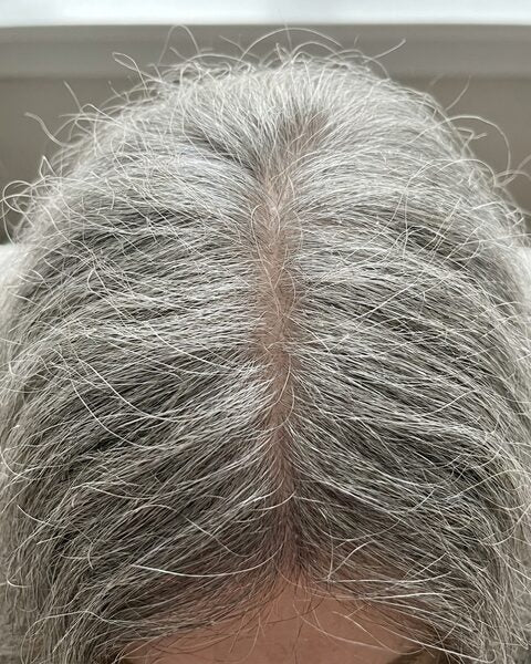 Cabello con canas antes del Tónico KapilUp